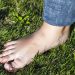 Barefoot with plantar fasciitis