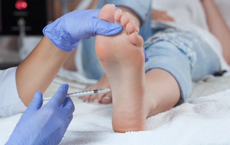 cortisone shot in heel for plantar fasciitis