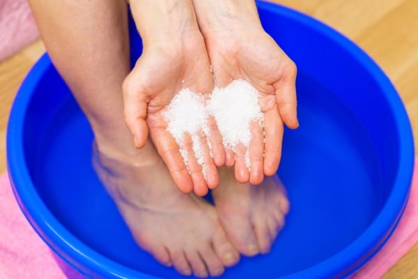 home cure for plantar fasciitis